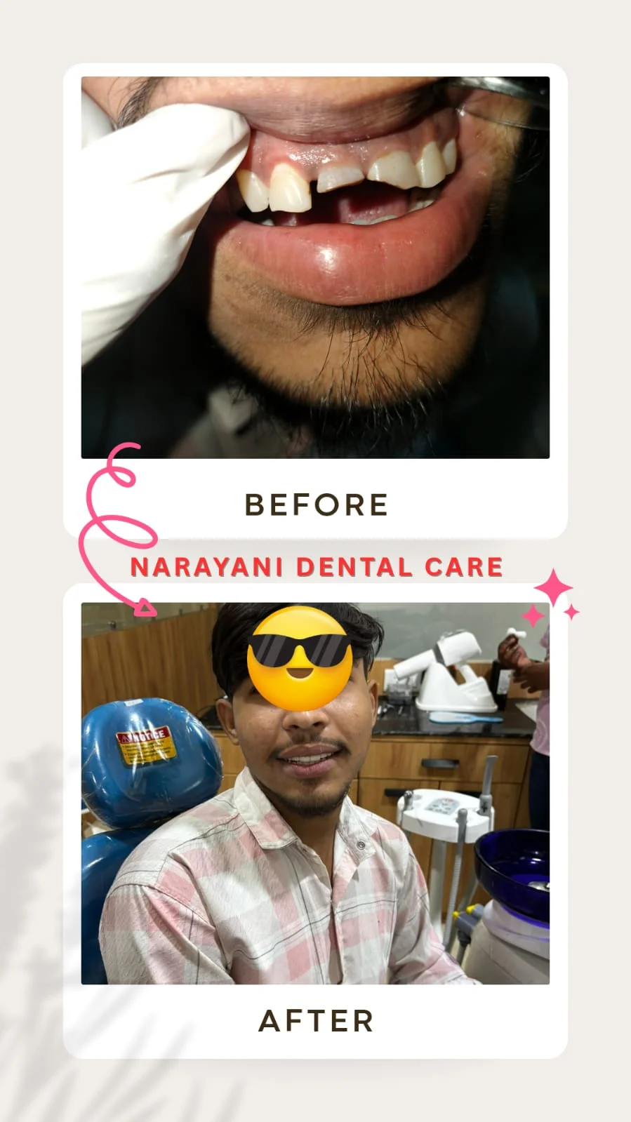 Before and after cosmetic dentistry