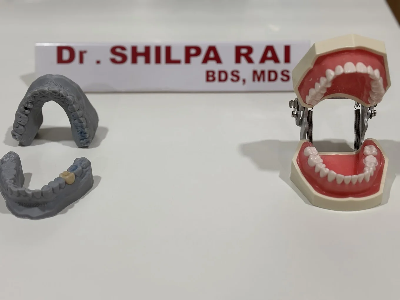Teeth whitening and dental models at Narayani Dental Care
